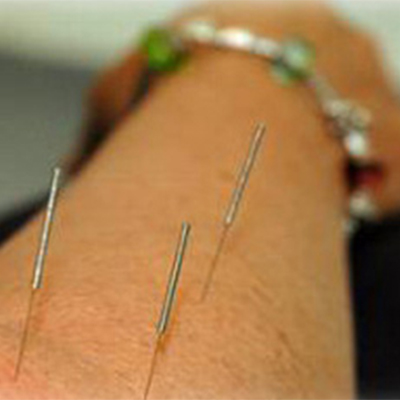 Acupuncture